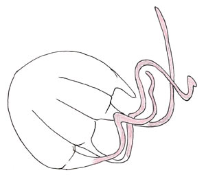 クラゲ（イラスト）